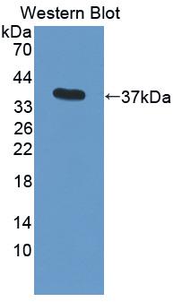 PAA847Hu06.jpg