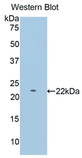 Polyclonal Antibody to Glycogen Phosphorylase, Muscle (PYGM)