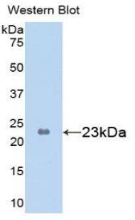 Polyclonal Antibody to Glycogen Phosphorylase, Liver (PYGL)