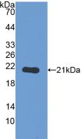 Polyclonal Antibody to Glycogen Phosphorylase, Liver (PYGL)