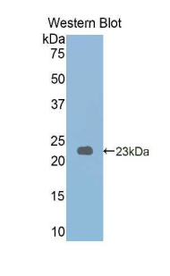 Polyclonal Antibody to Glycogen Phosphorylase, Liver (PYGL)