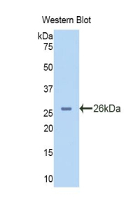 Polyclonal Antibody to Glycogen Phosphorylase, Liver (PYGL)