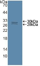 Polyclonal Antibody to Caspase 8 (CASP8)