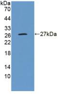 Polyclonal Antibody to Aminopeptidase A (ENPEP)