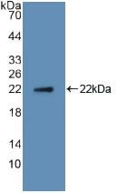 Polyclonal Antibody to Receptor Activator Of Nuclear Factor Kappa B Ligand (RANkL)