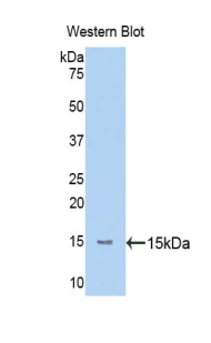 Polyclonal Antibody to Mannose Associated Serine Protease 2 (MASP2)