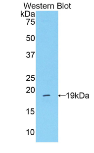 Polyclonal Antibody to Mannose Associated Serine Protease 2 (MASP2)