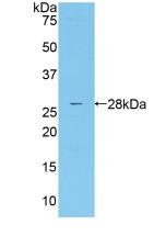 Polyclonal Antibody to Mannose Associated Serine Protease 2 (MASP2)