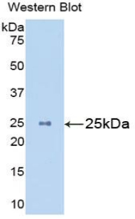 Polyclonal Antibody to Mannose Associated Serine Protease 2 (MASP2)