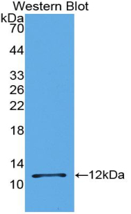 Polyclonal Antibody to Epithelial Neutrophil Activating Peptide 78 (ENA78)