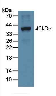 Polyclonal Antibody to Epithelial Neutrophil Activating Peptide 78 (ENA78)