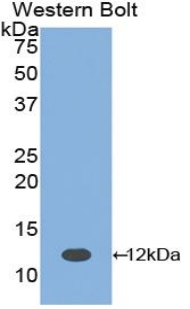 Polyclonal Antibody to Parathyroid Hormone (PTH)