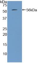 Polyclonal Antibody to Parathyroid Hormone (PTH)