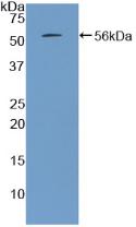 Polyclonal Antibody to Parathyroid Hormone (PTH)