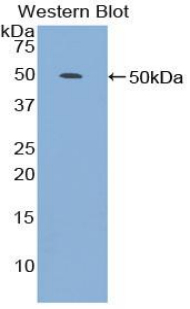 Polyclonal Antibody to Phospholipase A2 Group VII (LpPLA2)