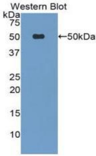 Polyclonal Antibody to Phospholipase A2 Group VII (LpPLA2)