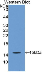 Polyclonal Antibody to Endothelial NOS (eNOS)