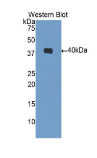 Polyclonal Antibody to Heat Shock Protein 40 (HSP40)