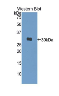 Polyclonal Antibody to Carbonic Anhydrase I (CA1)