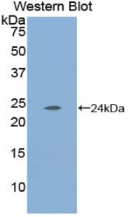 Polyclonal Antibody to Carbonic Anhydrase I (CA1)