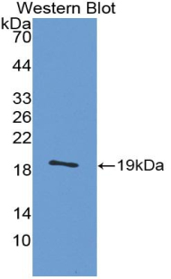 Polyclonal Antibody to Calcitonin Gene Related Peptide (CGRP)