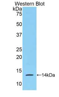 Polyclonal Antibody to Serum Amyloid A (SAA)