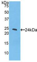 Polyclonal Antibody to Peroxisome Proliferator Activated Receptor Gamma (PPARg)