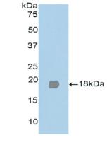 Polyclonal Antibody to Peroxisome Proliferator Activated Receptor Gamma (PPARg)