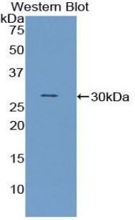 Polyclonal Antibody to Pyruvate Dehydrogenase Phosphatase (PDP)