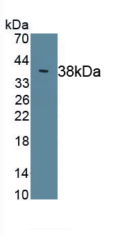 Polyclonal Antibody to Complement Component 4 (C4)