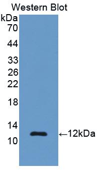 Polyclonal Antibody to Renin (REN)