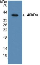 Polyclonal Antibody to Insulin Receptor (INSR)