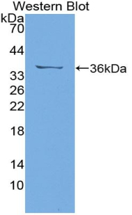 FITC-Linked Polyclonal Antibody to Insulin Receptor (INSR)