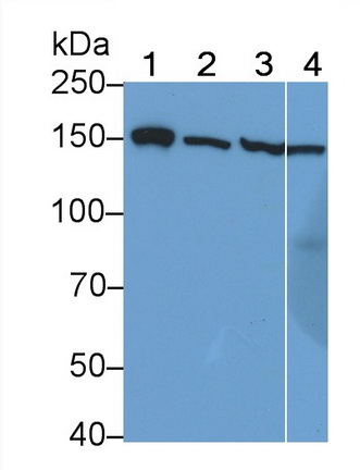 Polyclonal Antibody to Insulin Receptor (INSR)