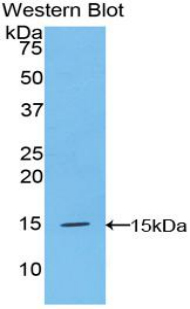 Polyclonal Antibody to Cystatin C (Cys-C)