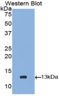 Polyclonal Antibody to Cystatin C (Cys-C)