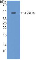 Polyclonal Antibody to Cystatin C (Cys-C)