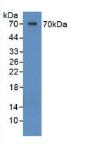 Polyclonal Antibody to Osteopontin (OPN)