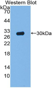 Polyclonal Antibody to Acid Phosphatase 5, Tartrate Resistant (ACP5)