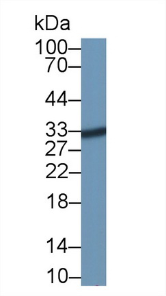 Polyclonal Antibody to Acid Phosphatase 5, Tartrate Resistant (ACP5)