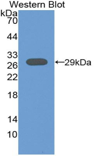 Polyclonal Antibody to Acid Phosphatase 5, Tartrate Resistant (ACP5)