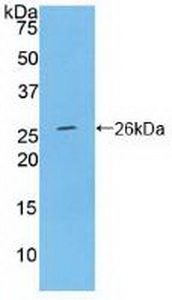 Polyclonal Antibody to Ceruloplasmin (CP)