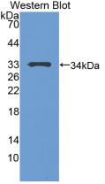 Polyclonal Antibody to Tumor Protein p53 (P53)