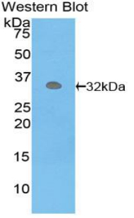 Polyclonal Antibody to Phosphoenolpyruvate Carboxykinase 1, Soluble (PCK1)