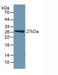 Polyclonal Antibody to Phosphoenolpyruvate Carboxykinase 1, Soluble (PCK1)