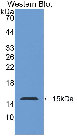 Polyclonal Antibody to Nephrin (NPHN)