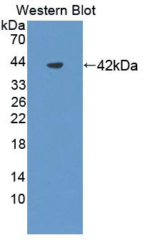 Polyclonal Antibody to Nephrin (NPHN)