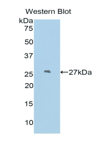 Polyclonal Antibody to Podocin (PDCN)