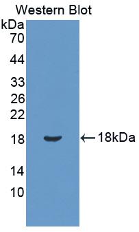 Polyclonal Antibody to Podocin (PDCN)