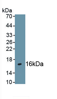 Polyclonal Antibody to Chemokine C-X-C-Motif Receptor 4 (CXCR4)